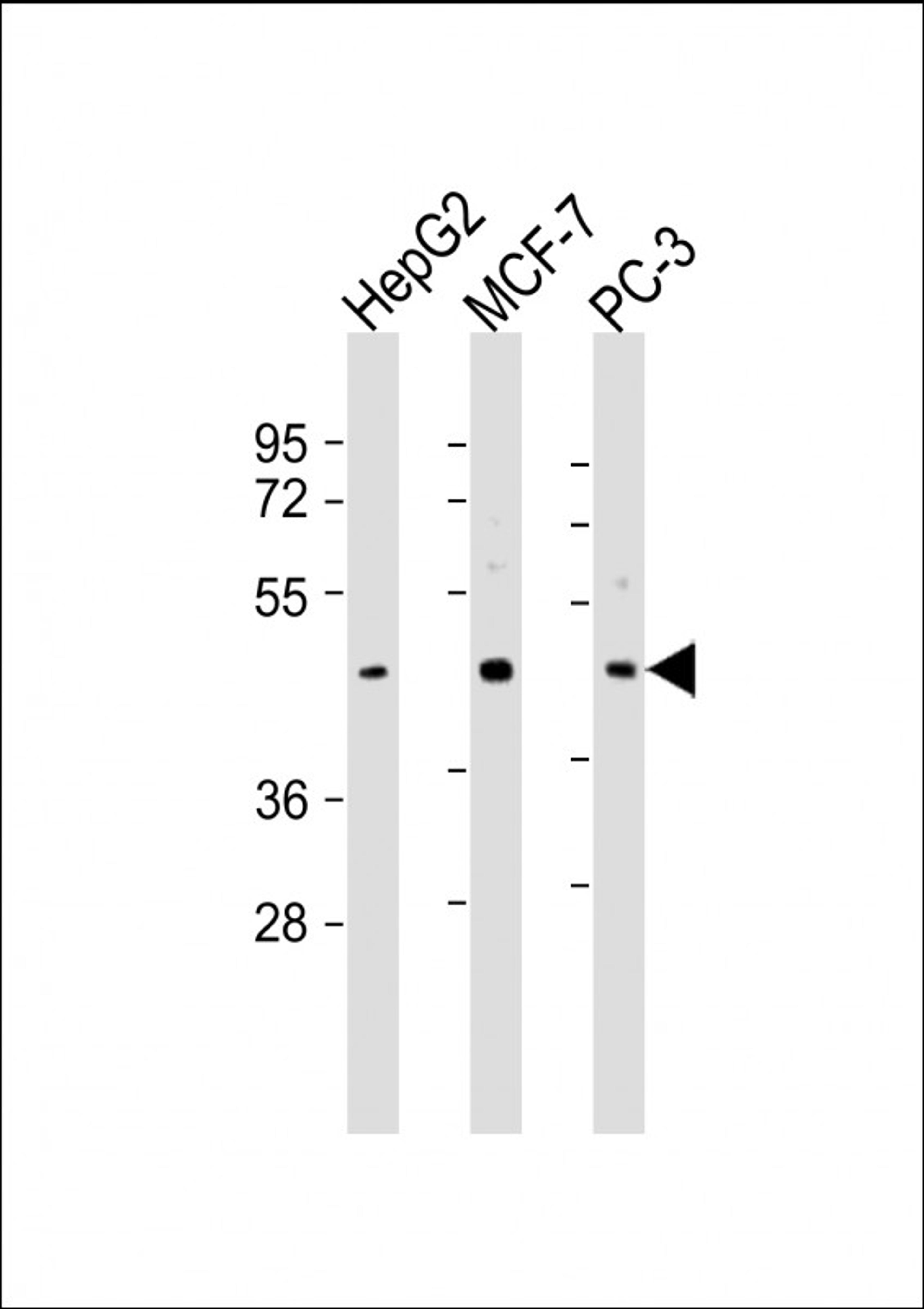 Western Blot at 1:2000 dilution Lane 1: HepG2 whole cell lysate Lane 2: MCF-7 whole cell lysate Lane 3: PC-3 whole cell lysate Lysates/proteins at 20 ug per lane.