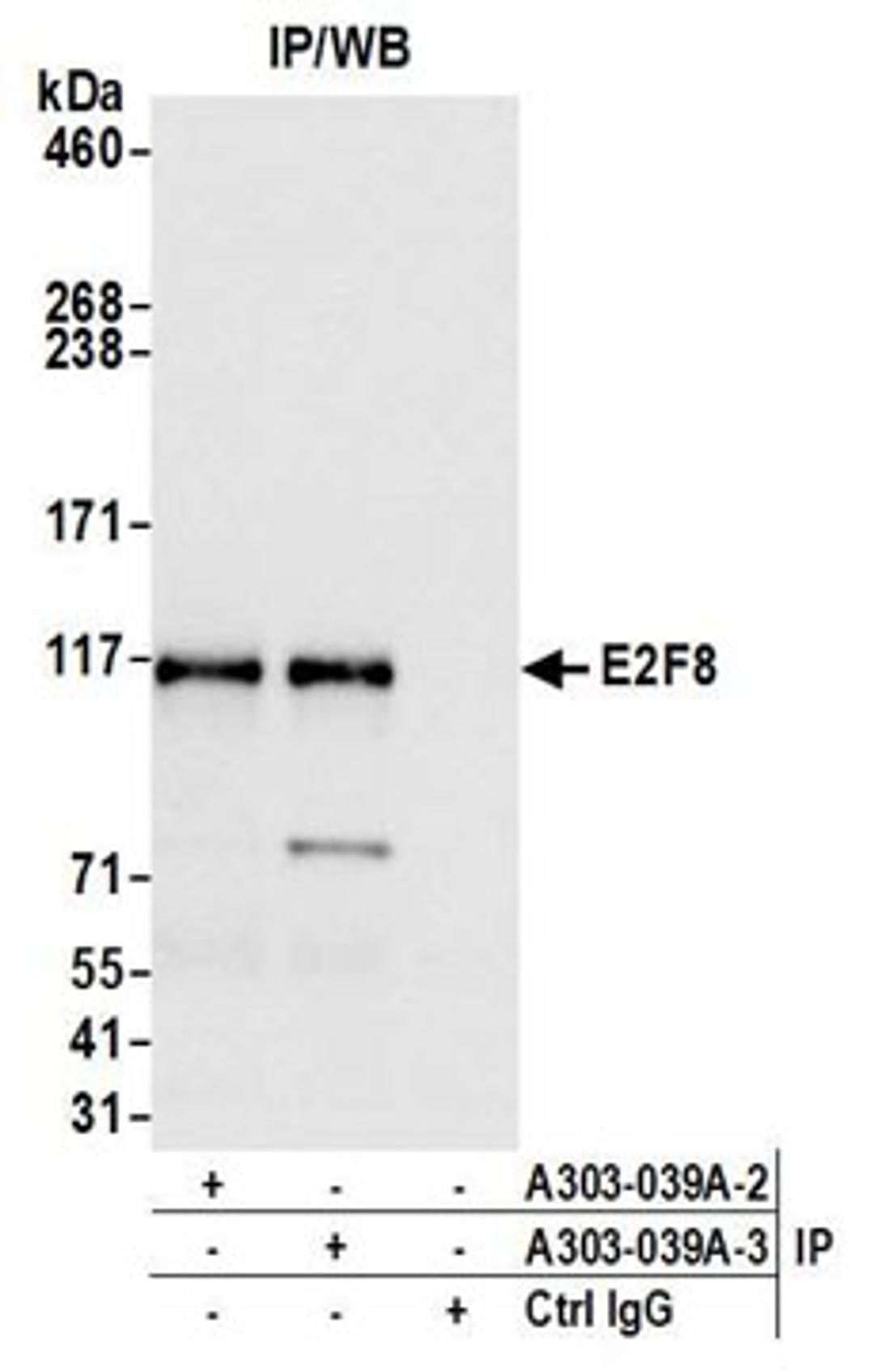 Detection of human E2F8 by western blot of immunoprecipitates.