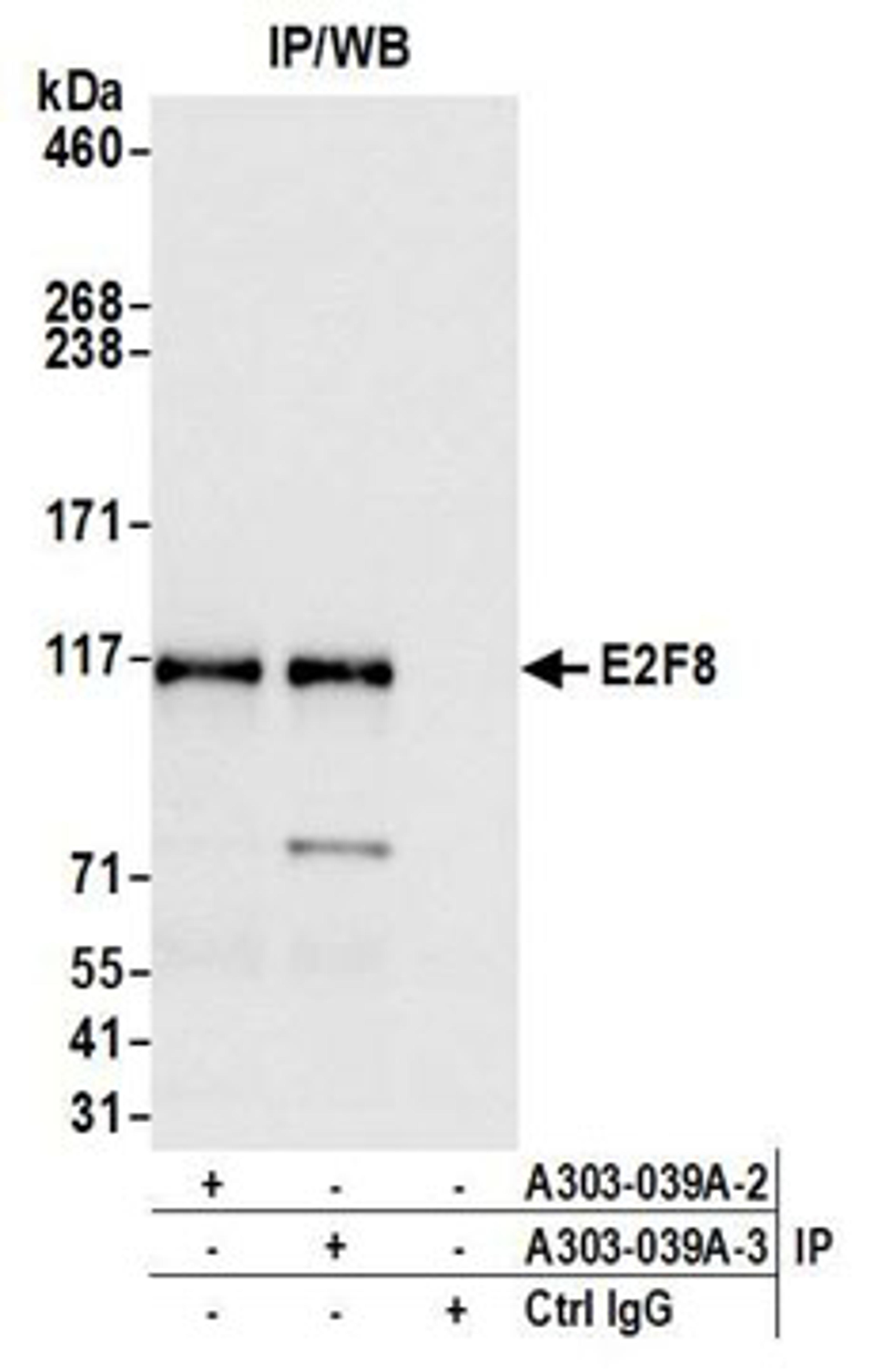 Detection of human E2F8 by western blot of immunoprecipitates.