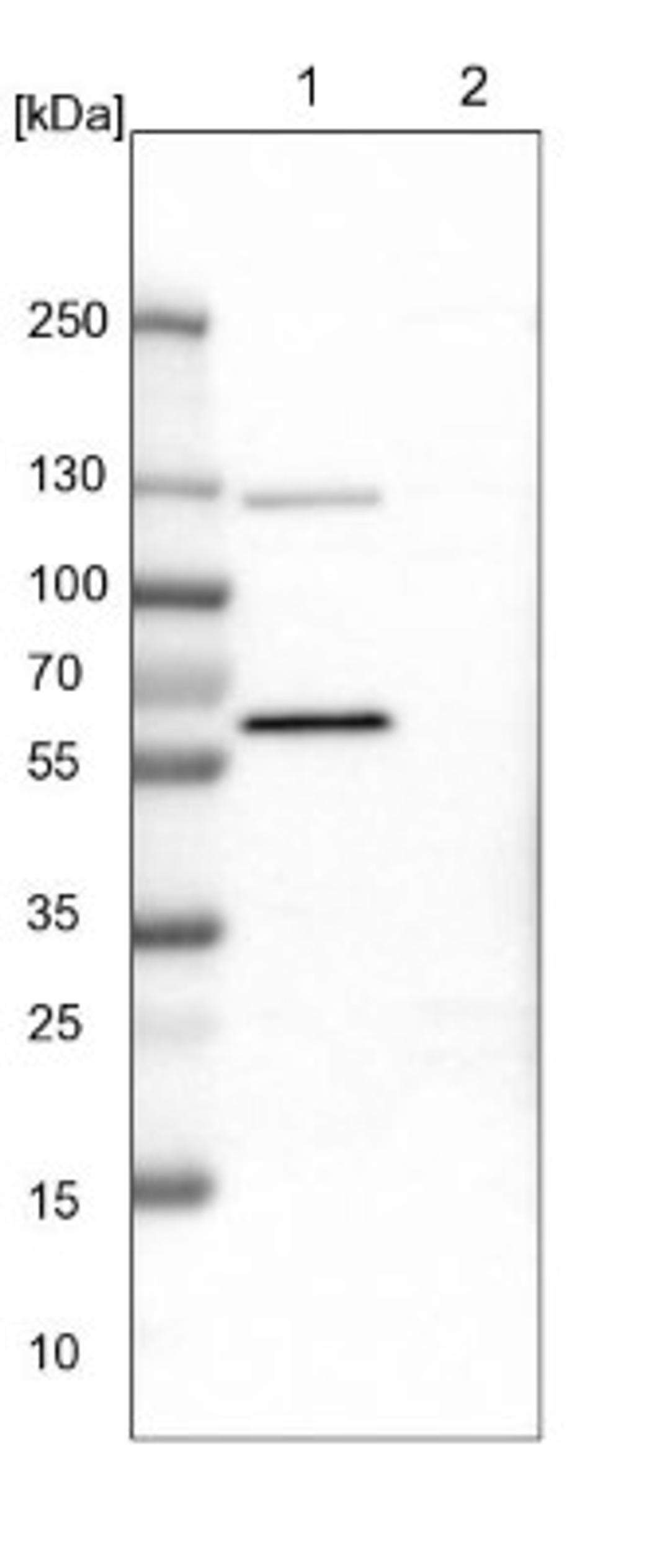 Western Blot: ODR4/TTG1 Antibody [NBP1-82177] - Lane 1: NIH-3T3 cell lysate (Mouse embryonic fibroblast cells)<br/>Lane 2: NBT-II cell lysate (Rat Wistar bladder tumour cells)