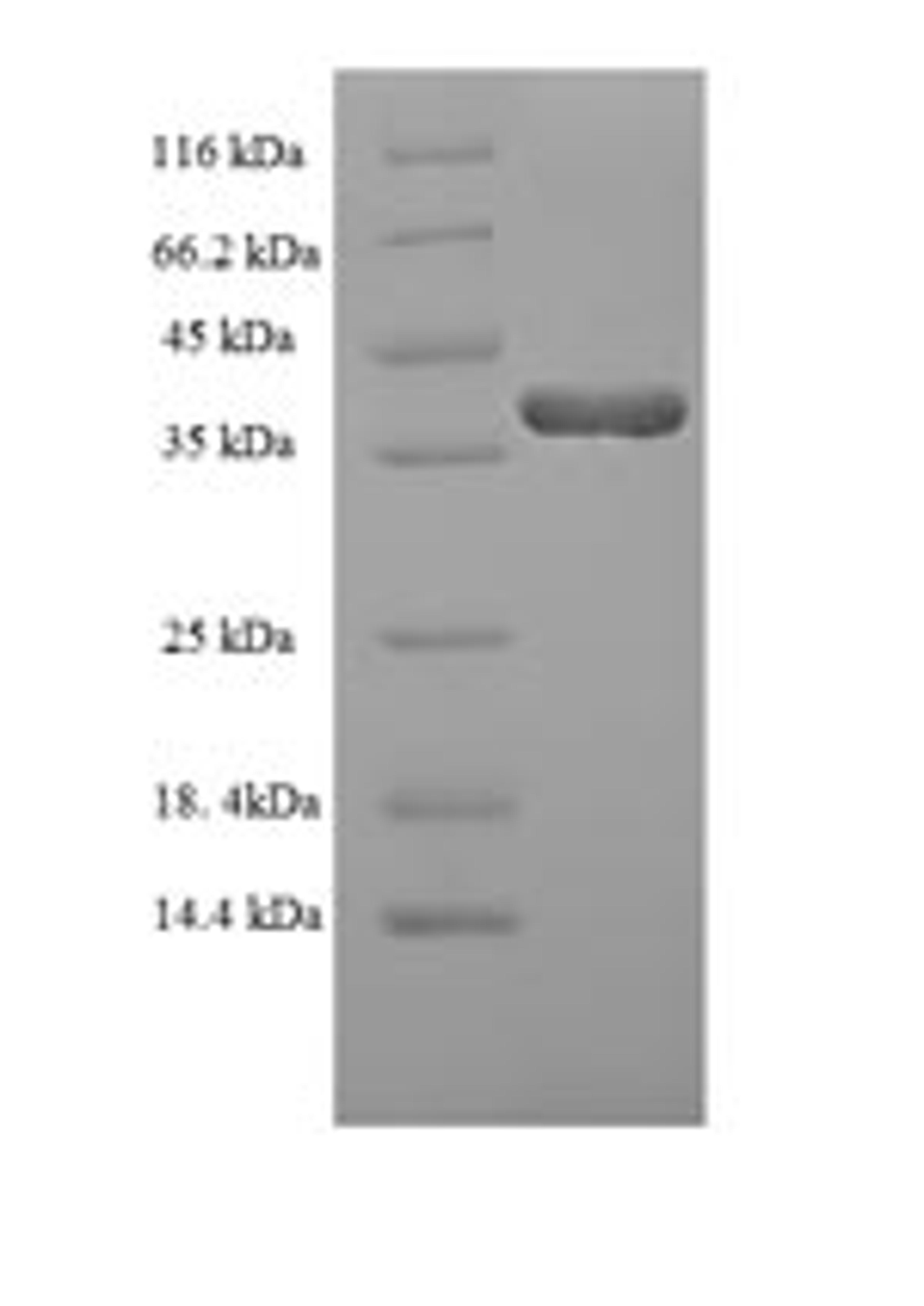 (Tris-Glycine gel) Discontinuous SDS-PAGE (reduced) with 5% enrichment gel and 15% separation gel.