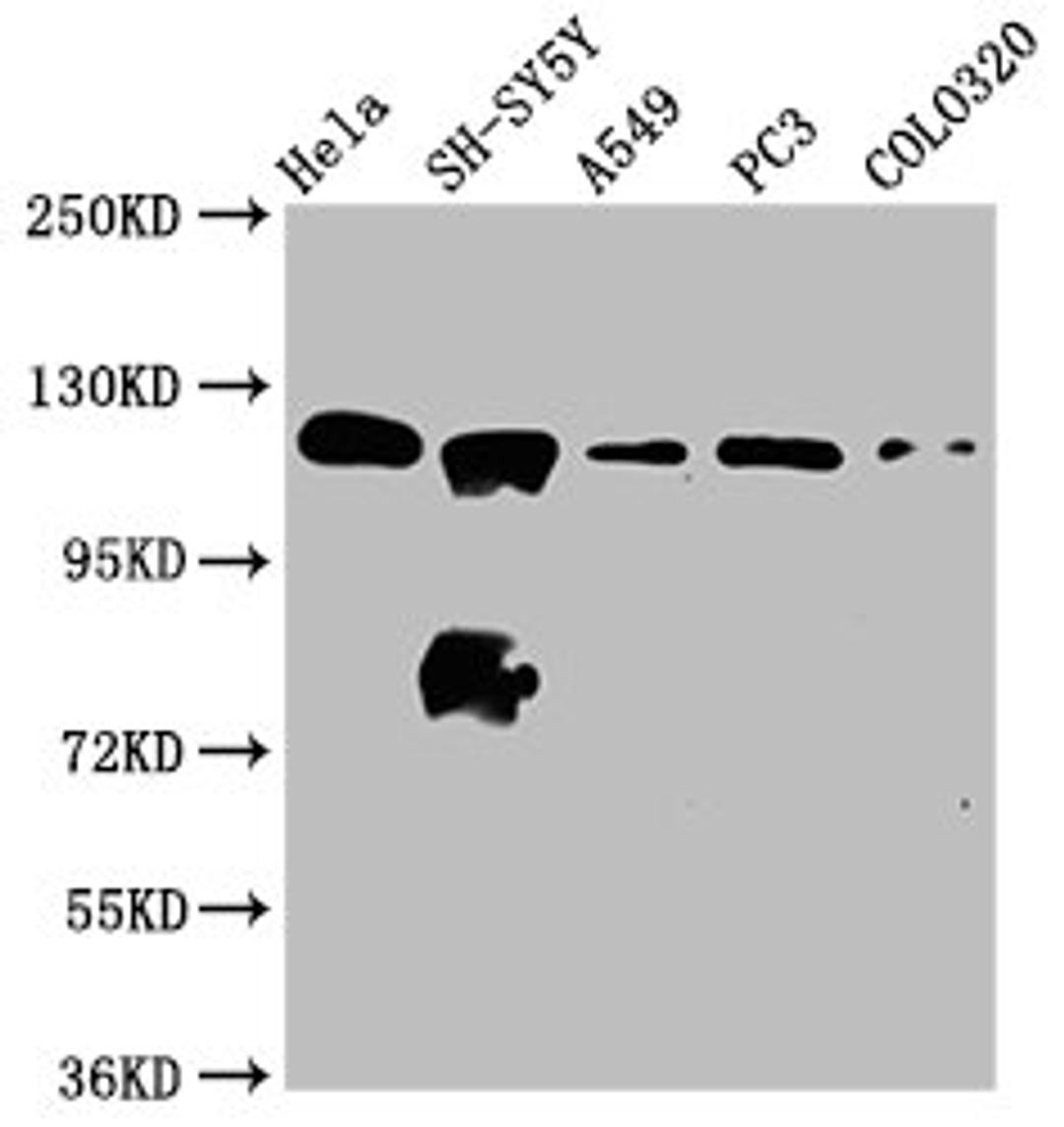 Western Blot. Positive WB detected in: Hela whole cell lysate, SH-SY5Y whole cell lysate, A549 whole cell lysate, PC-3 whole cell lysate, COLO320 whole cell lysate. All lanes: MAML2 antibody at 2.2ug/ml. Secondary. Goat polyclonal to rabbit IgG at 1/50000 dilution. Predicted band size: 126 kDa. Observed band size: 126 kDa. 