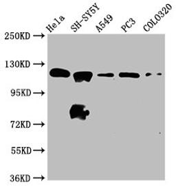 Western Blot. Positive WB detected in: Hela whole cell lysate, SH-SY5Y whole cell lysate, A549 whole cell lysate, PC-3 whole cell lysate, COLO320 whole cell lysate. All lanes: MAML2 antibody at 2.2ug/ml. Secondary. Goat polyclonal to rabbit IgG at 1/50000 dilution. Predicted band size: 126 kDa. Observed band size: 126 kDa. 