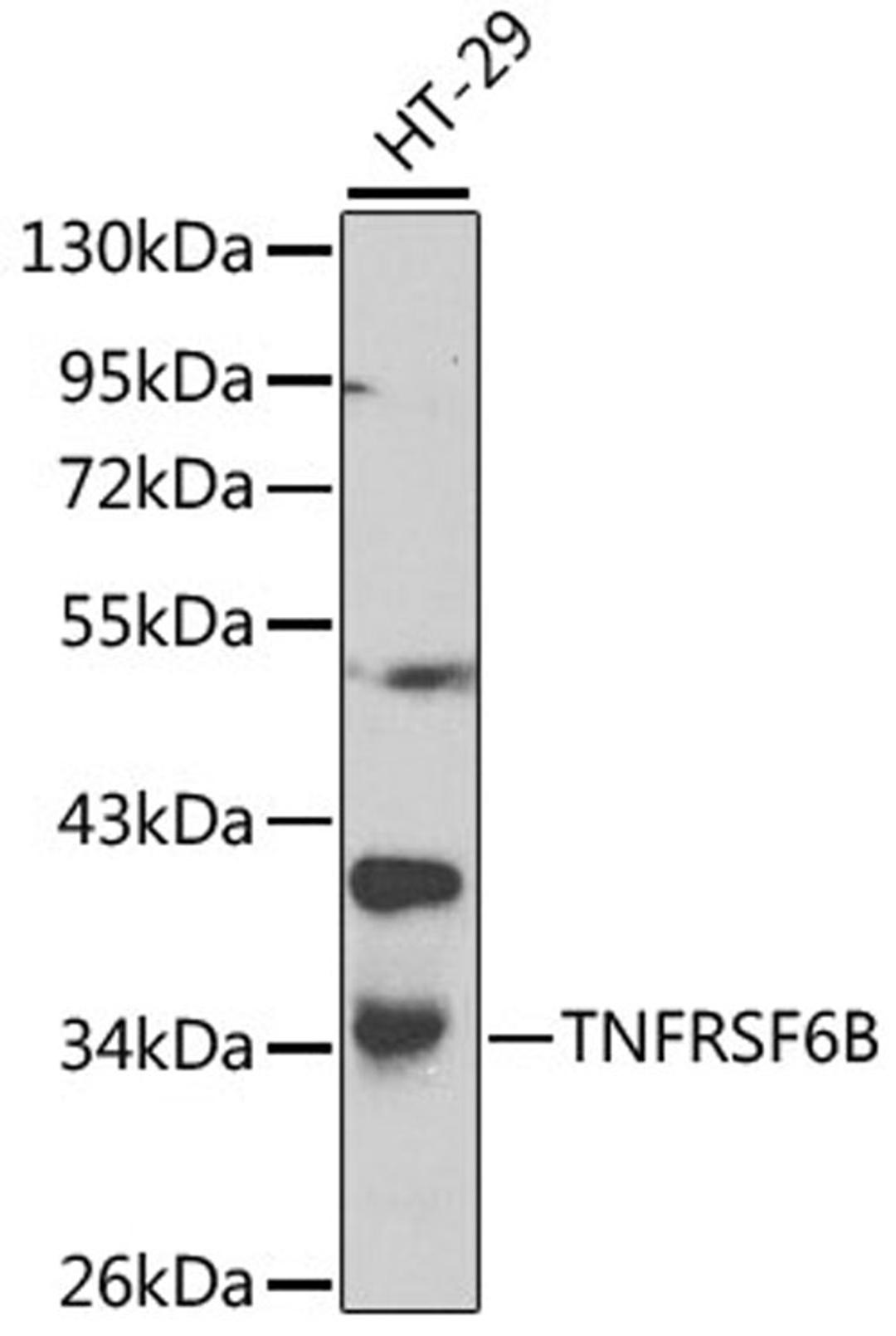 Western blot - TNFRSF6B antibody (A0649)