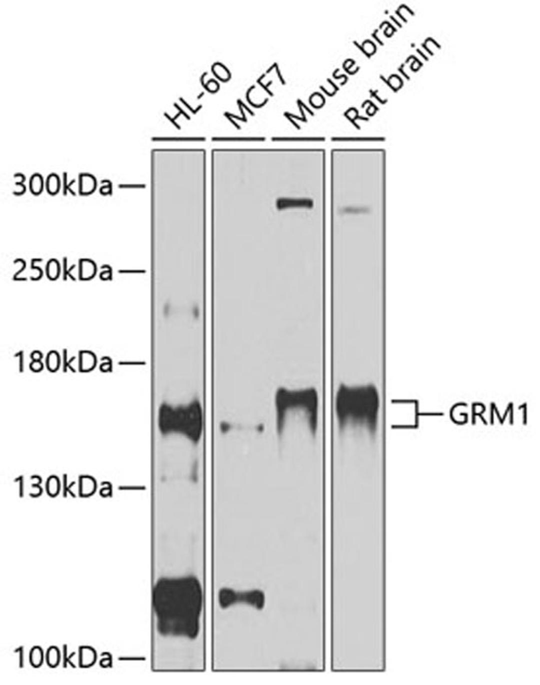 Western blot - GRM1 antibody (A11462)