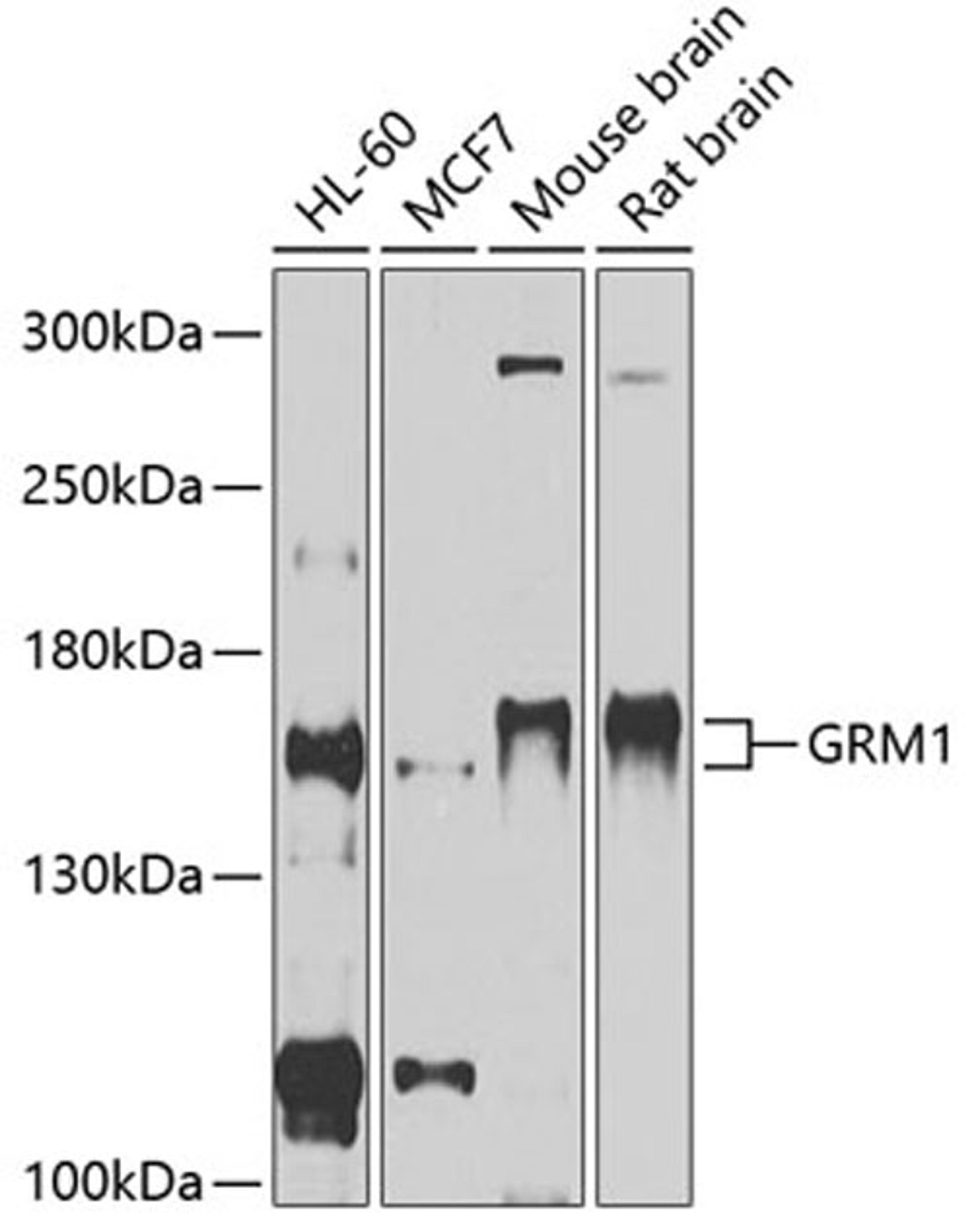 Western blot - GRM1 antibody (A11462)