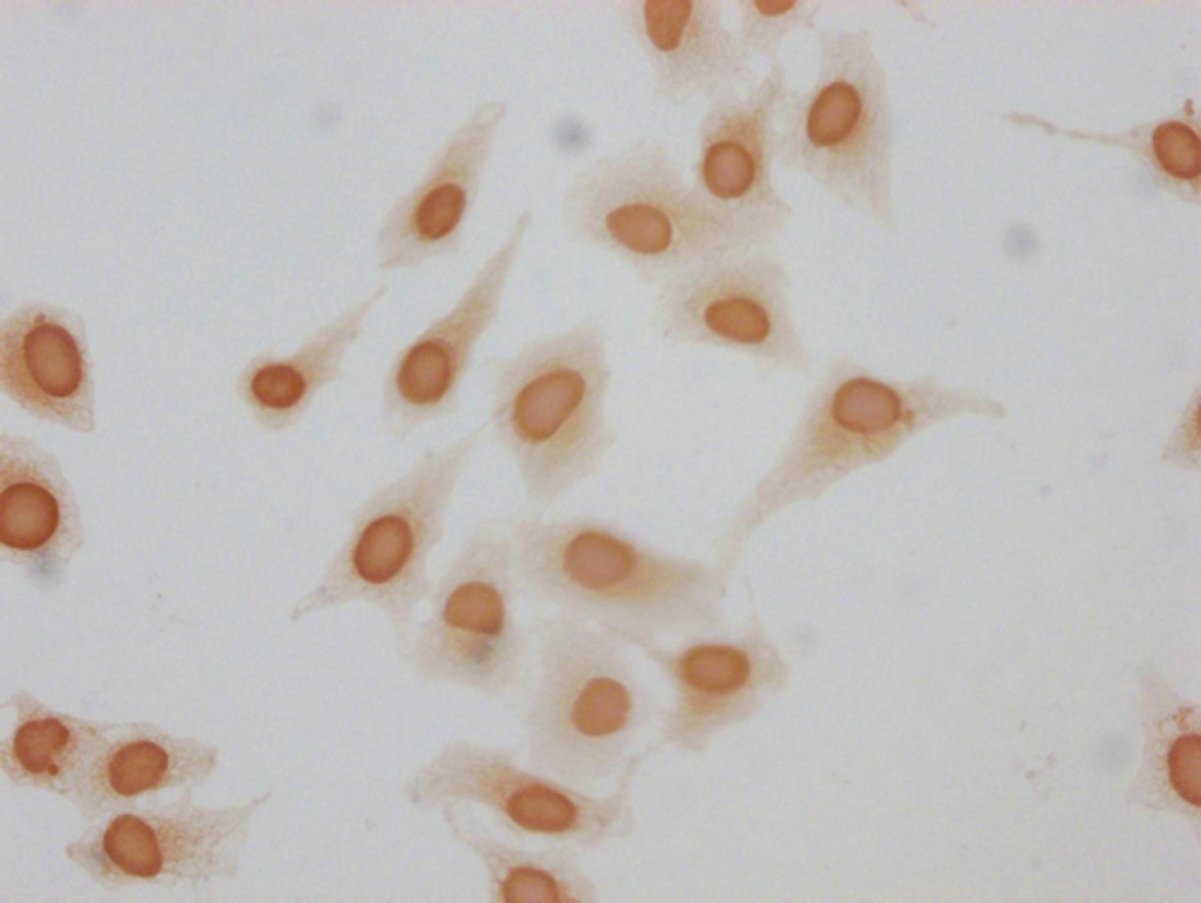 Immunocytochemistry analysis of CSB-PA010380OA62forHU diluted at 1:10 and staining in Hela cells(treated with 30mM sodium butyrate for 4h) performed on a Leica BondTM system. The cells were fixed in 4% formaldehyde, permeabilized using 0.2% Triton X-100 and blocked with 10% normal goat serum 30min at RT. Then primary antibody (1% BSA) was incubated at 4°C overnight. The primary is detected by a biotinylated secondary antibody and visualized using an HRP conjugated SP system.