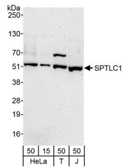 Detection of human SPTLC1 by western blot.