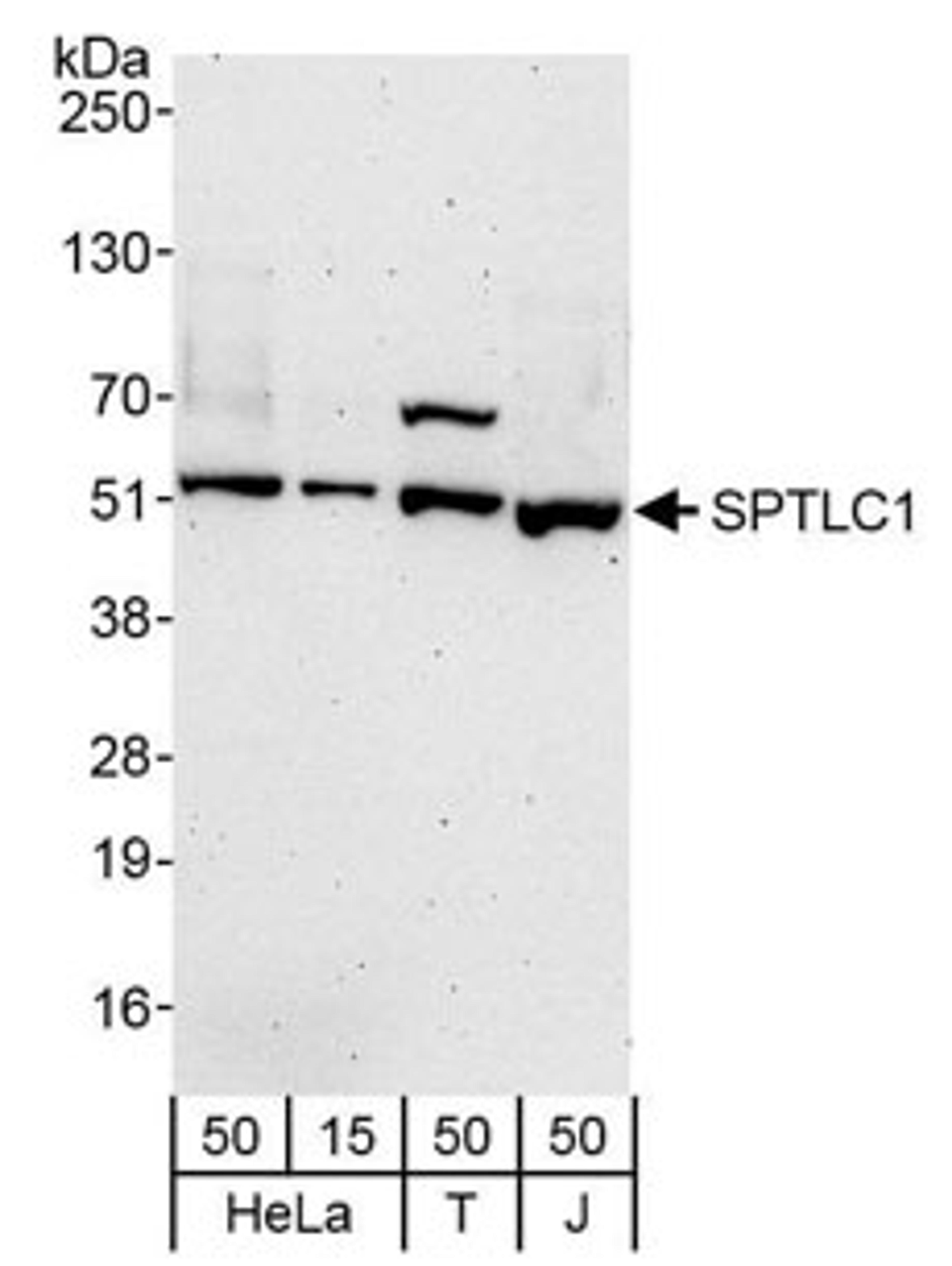 Detection of human SPTLC1 by western blot.