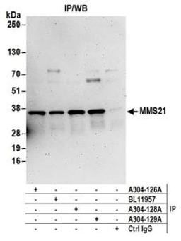 Detection of human MMS21 by western blot of immunoprecipitates.