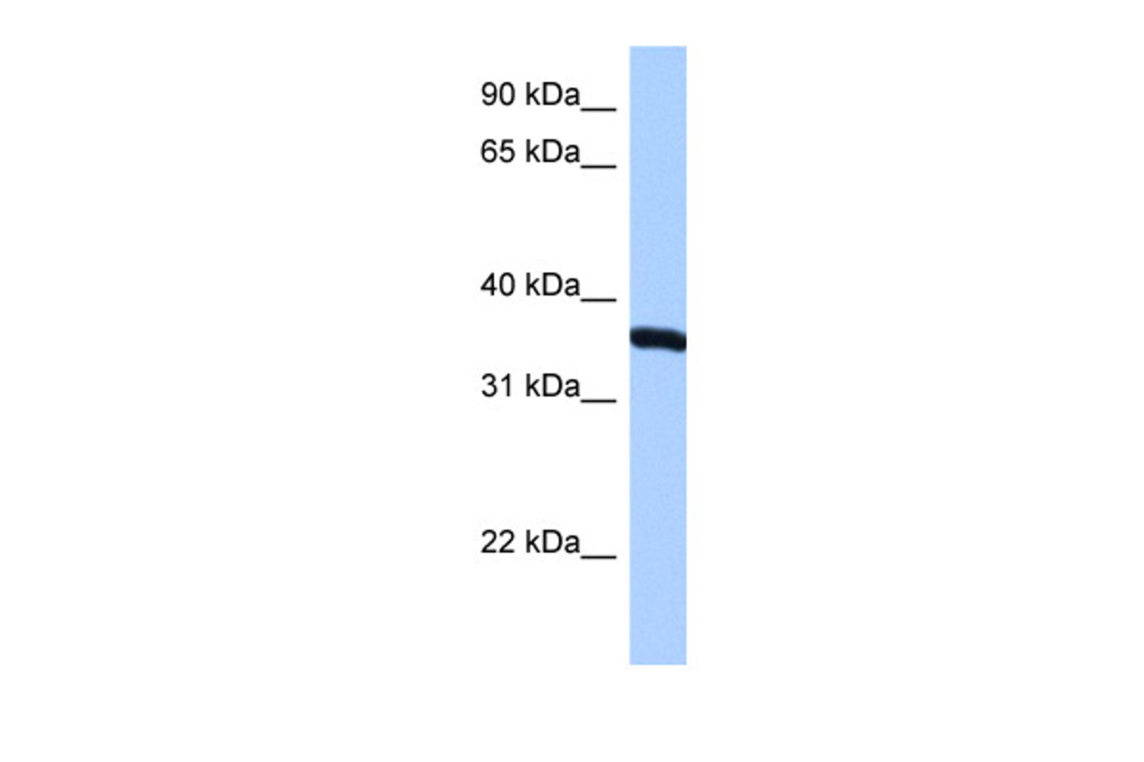 Antibody used in WB on Human HepG2 cells at 0.2-1 ug/ml.