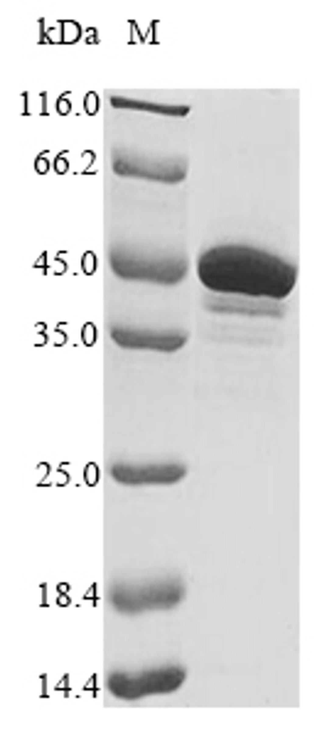(Tris-Glycine gel) Discontinuous SDS-PAGE (reduced) with 5% enrichment gel and 15% separation gel.