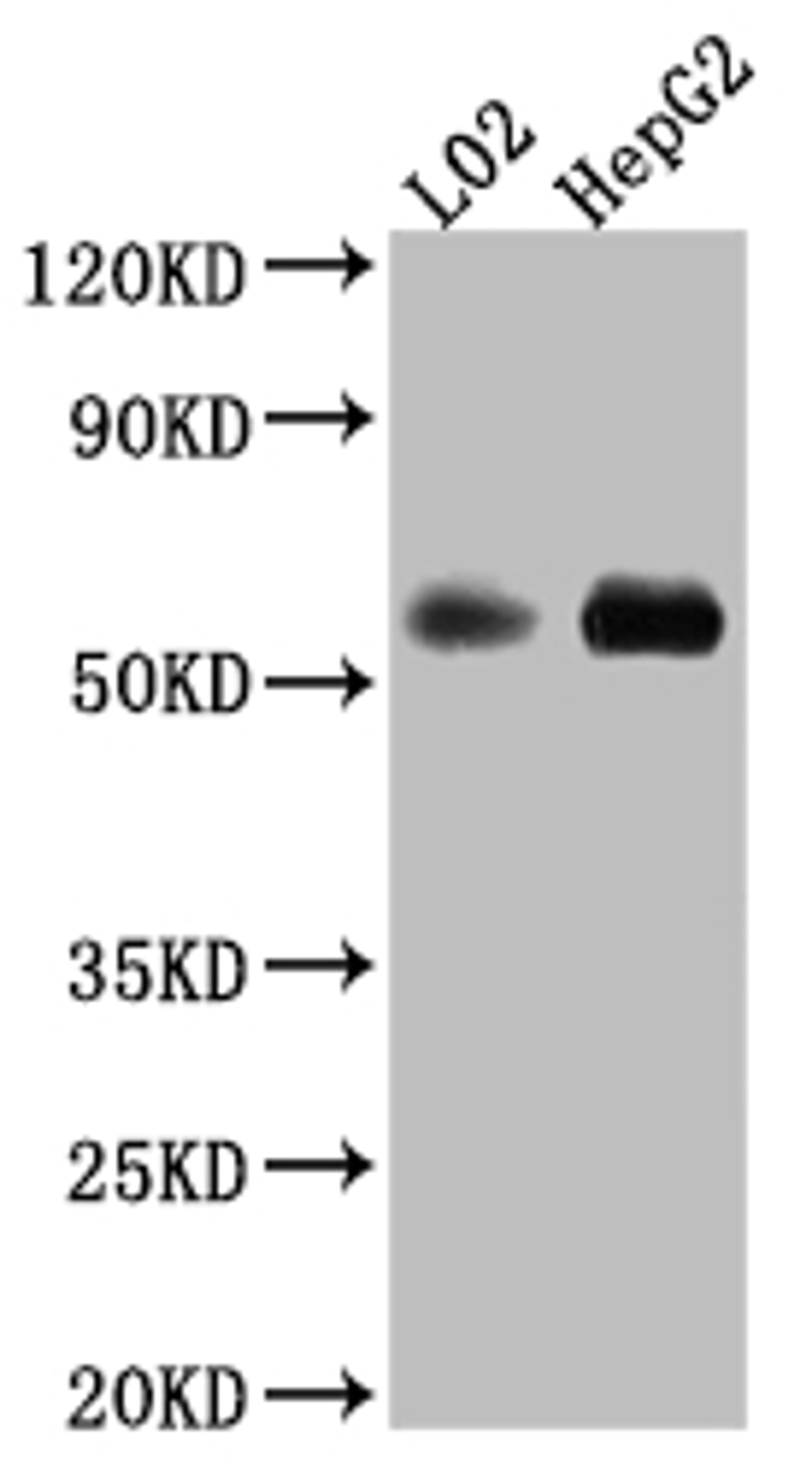 Western Blot. Positive WB detected in: L02 whole cell lysate, HepG2 whole cell lysate. All lanes: Monoamine Oxidase B Antibody at 1:1000. Secondary. Goat polyclonal to rabbit IgG at 1/50000 dilution. Predicted band size: 59, 47 kDa. Observed band size: 59 kDa. 