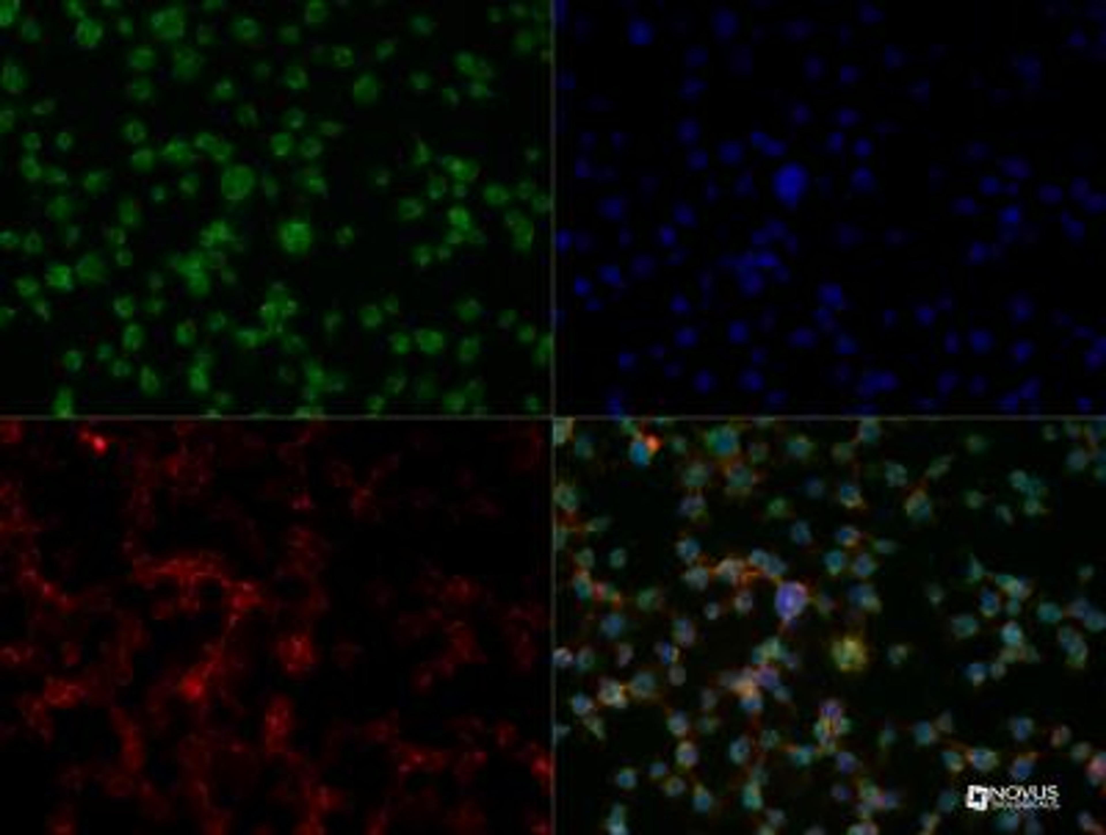 Immunocytochemistry/Immunofluorescence: Aiolos/IKZF3 Antibody [NBP2-24495] - IKZF3 antibody was tested in Jurkat cells at a 1:40 dilution against Dylight 488 (Green). Alpha tubulin and nuclei were counterstained against Dylight 568 (Red) and DAPI (Blue), respectively.