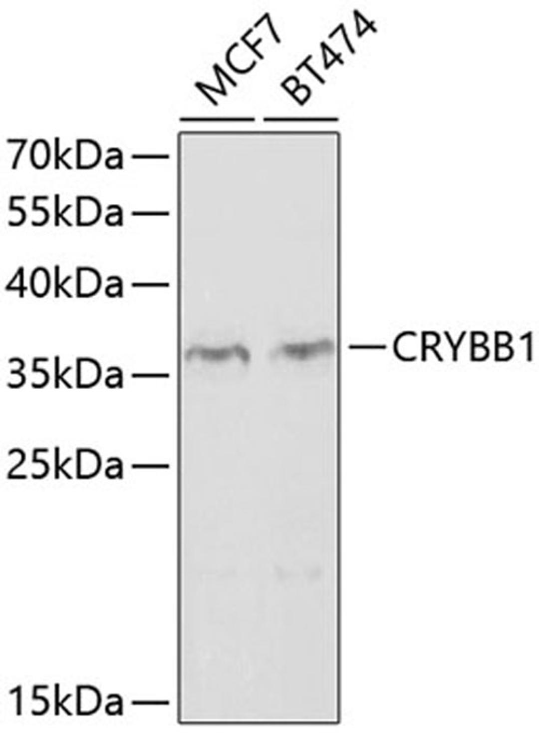 Western blot - CRYBB1 antibody (A2590)