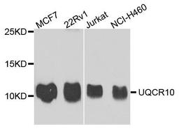 Western blot analysis of extract of various cells using UQCR10 antibody