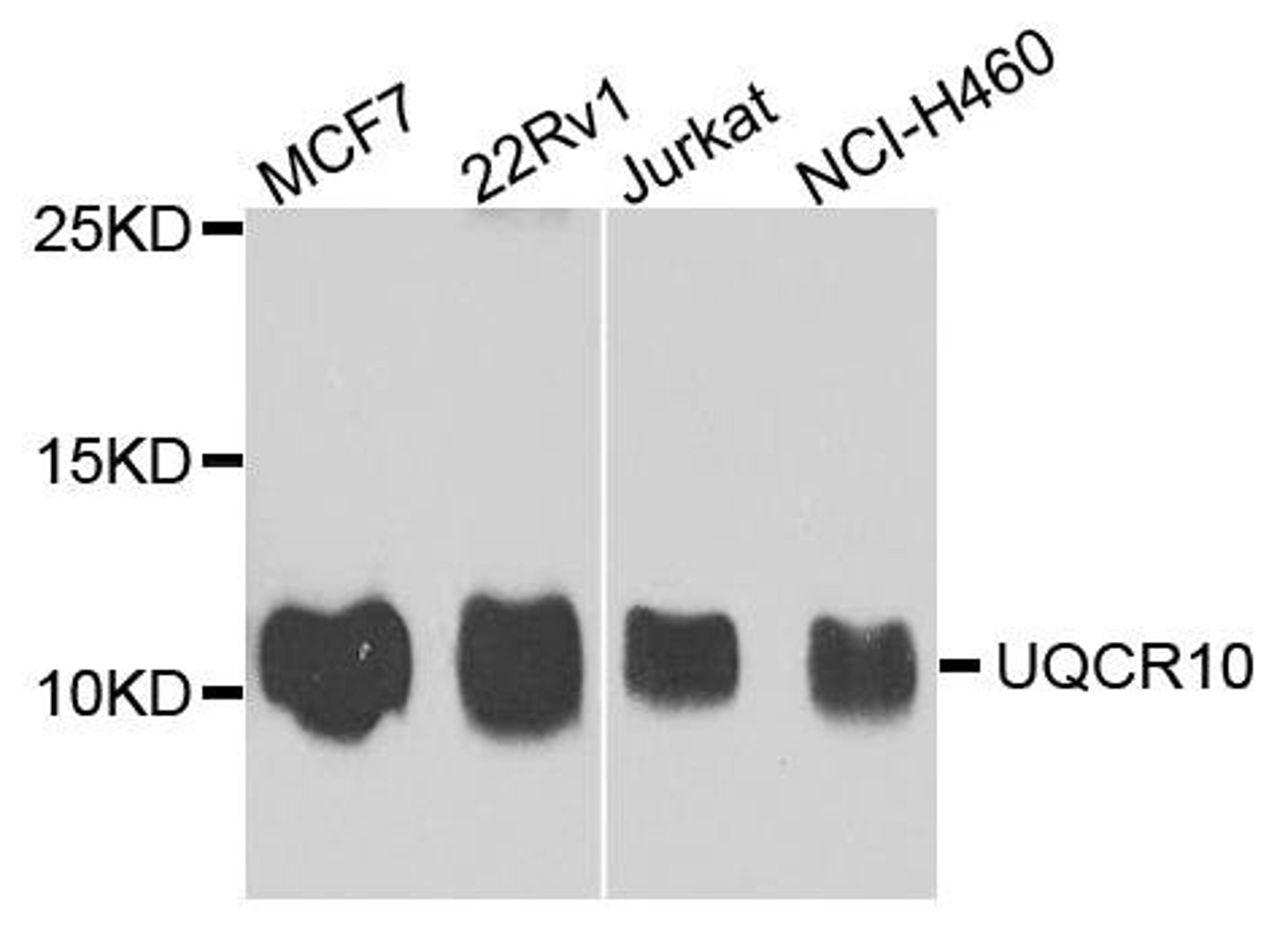 Western blot analysis of extract of various cells using UQCR10 antibody