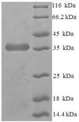 (Tris-Glycine gel) Discontinuous SDS-PAGE (reduced) with 5% enrichment gel and 15% separation gel.