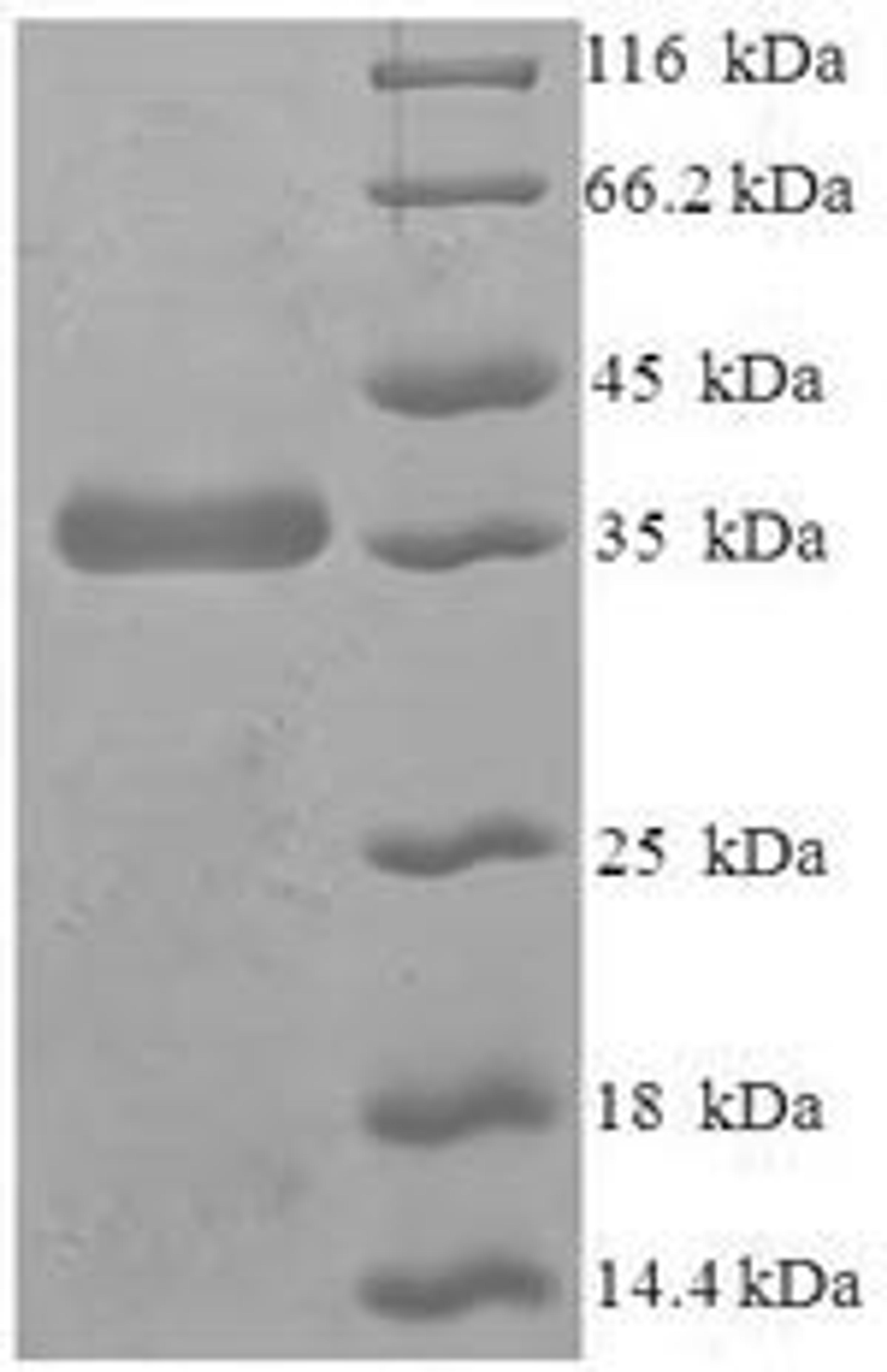 (Tris-Glycine gel) Discontinuous SDS-PAGE (reduced) with 5% enrichment gel and 15% separation gel.
