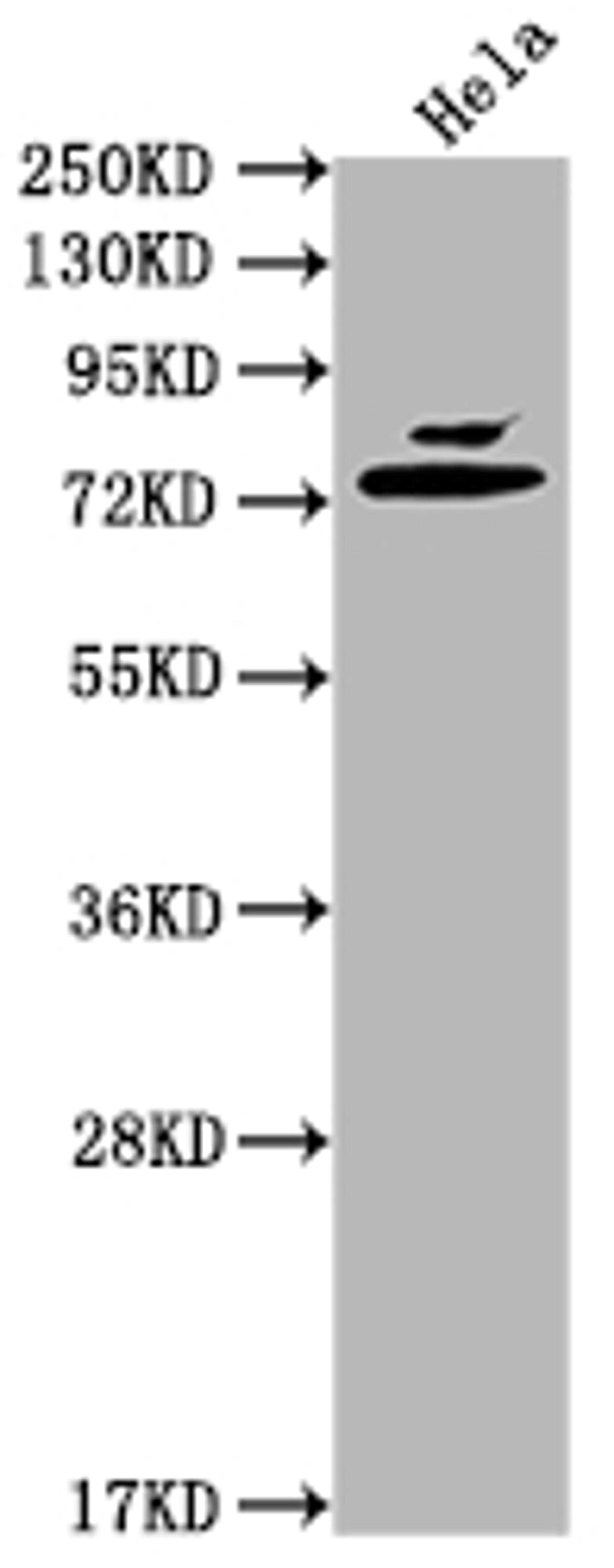 Western Blot. Positive WB detected in: Hela whole cell lysate. All lanes: Mmp2 antibody at 1:2000. Secondary. Goat polyclonal to rabbit IgG at 1/50000 dilution. Predicted band size: 75, 66 kDa. Observed band size: 75 kDa.
