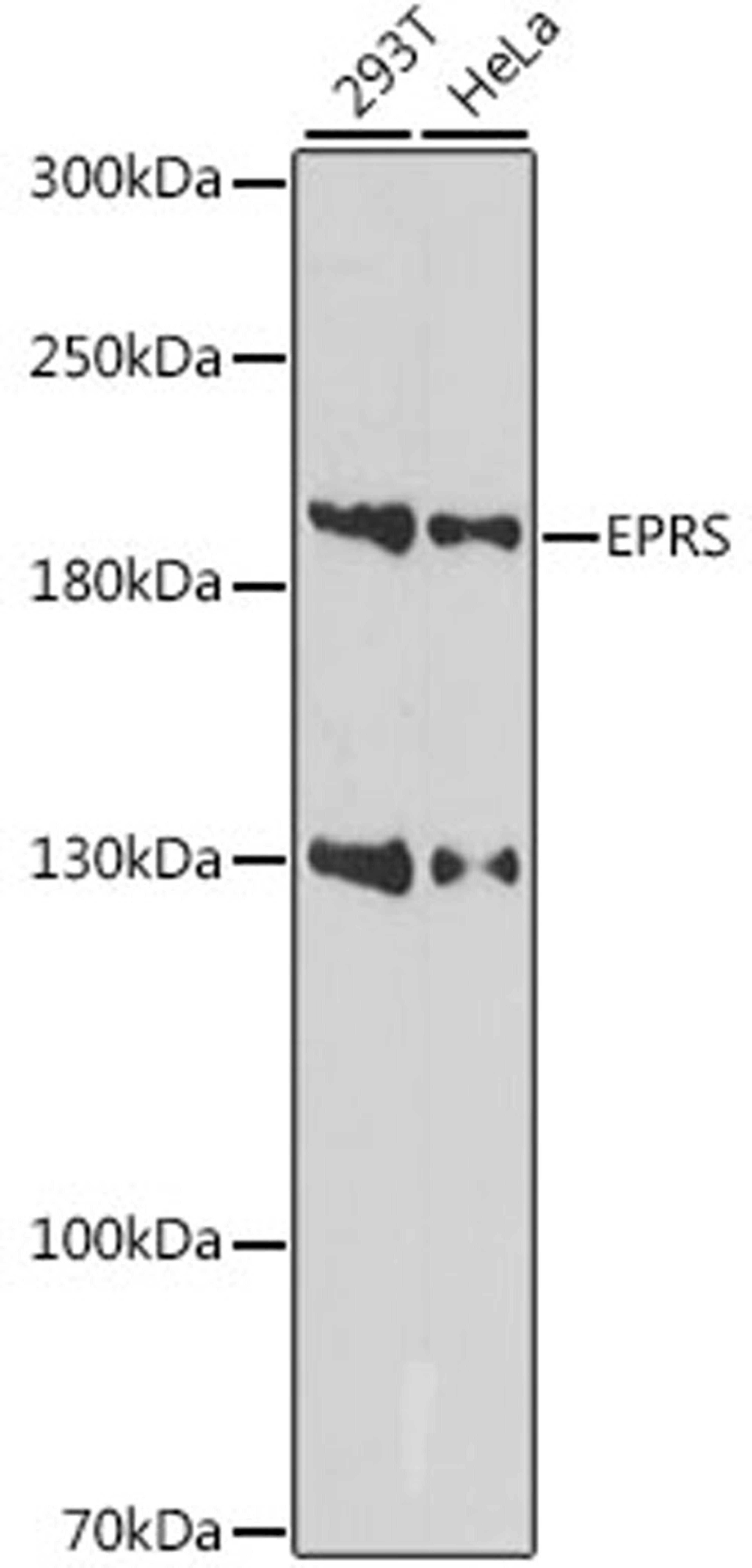 Western blot - EPRS antibody (A15245)