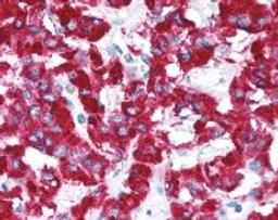 Immunohistochemistry staining of EIF2S1 in adrenal tissue using EIF2S1 Antibody.