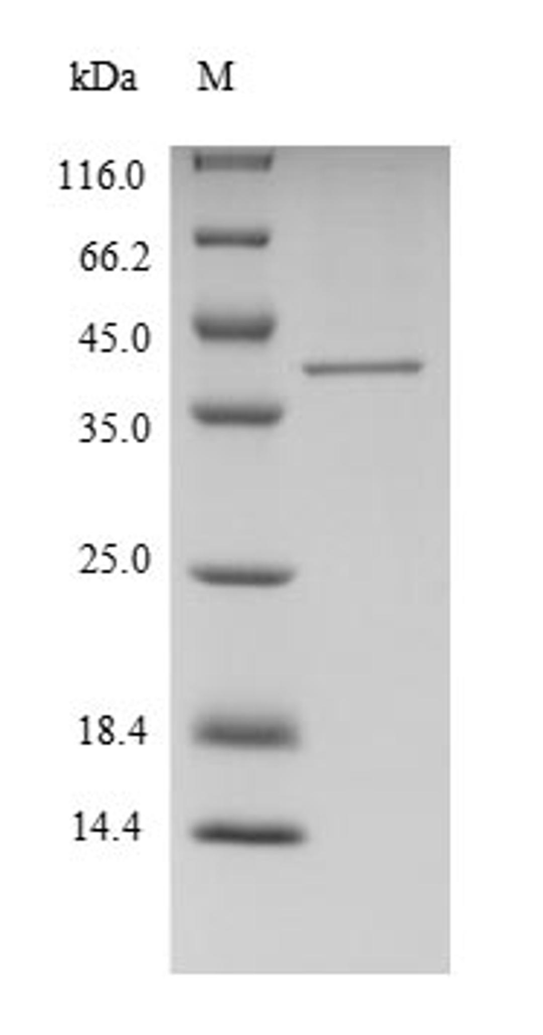 (Tris-Glycine gel) Discontinuous SDS-PAGE (reduced) with 5% enrichment gel and 15% separation gel.
