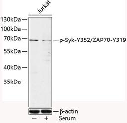 Western blot - Phospho-Syk-Y352/ZAP70-Y319 antibody (AP0501)