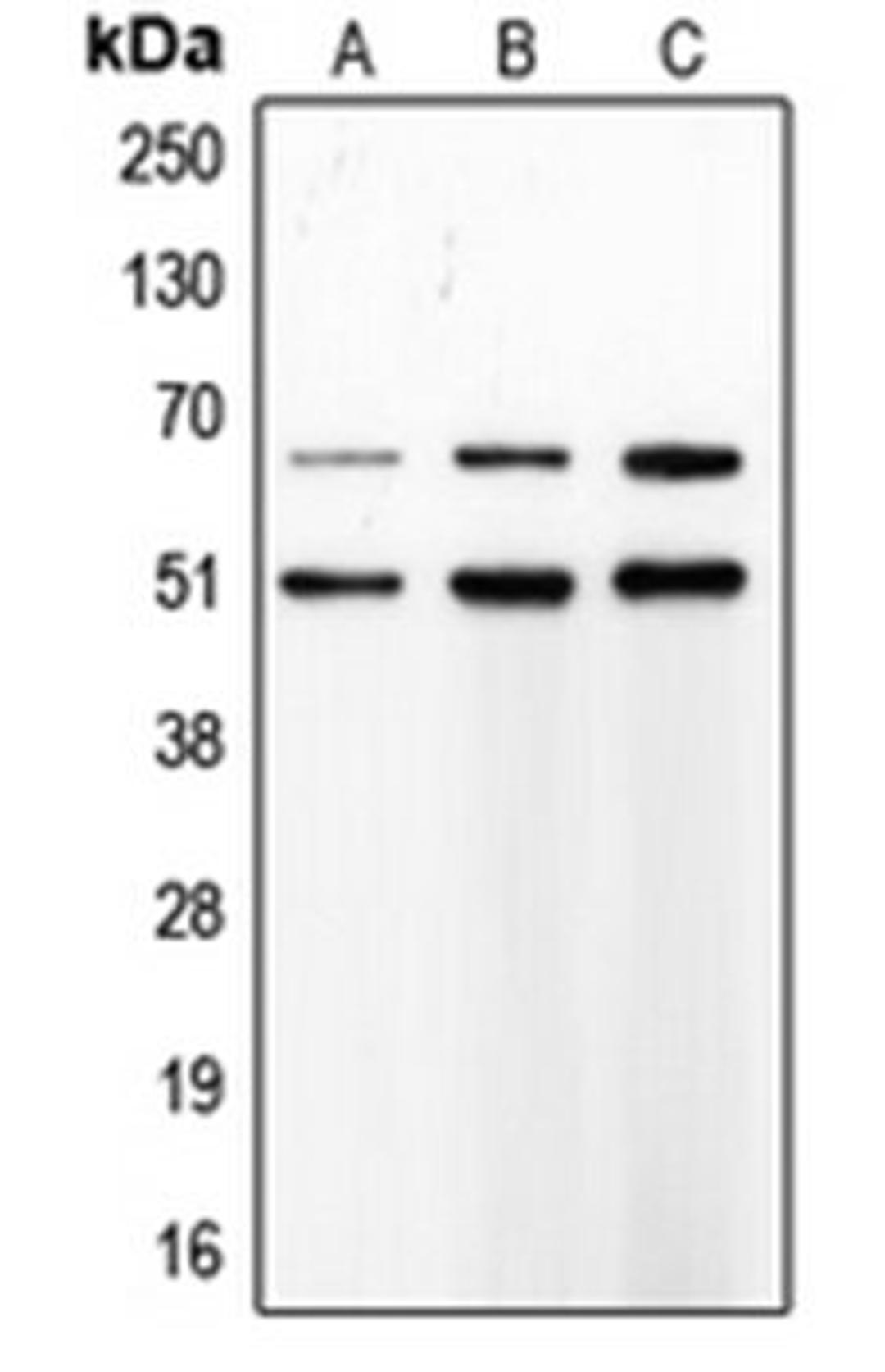 Western blot analysis of SJRH30 (Lane 1), PMNL (Lane 2), Sw620 (Lane 3) whole cell lysates using MMP8 antibody