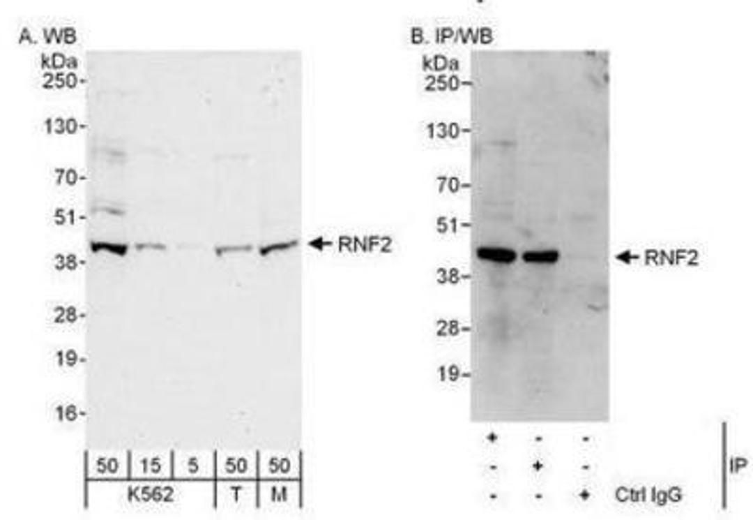 Western Blot: RNF2 Antibody [NBP1-49966] - Detection of Human and Mouse RNF2 by Western Blot (h&m) and Immunoprecipitation (h). Samples: Whole cell lysate from K562 (5, 15 and 50 mcg for WB; 1 mg for IP, 20% of IP loaded), 293T (T; 50 mcg), and mouse NIH3T3 (M; 50 mcg) cells.  Antibodies: Affinity purified rabbit anti-RNF2 antibody used for WB at 0.1 mcg/ml (A) and 1 mcg/ml (B) and used for IP at 3 mcg/mg lysate.  RNF2 was also immunoprecipitated by rabbit anti-RNF2 antibody, which recognizes a downstream epitope.  For blotting immunoprecipitated RNF2 was used.  Detection: Chemiluminescence with exposure times of 30 seconds (A and B).