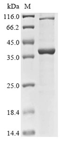(Tris-Glycine gel) Discontinuous SDS-PAGE (reduced) with 5% enrichment gel and 15% separation gel.