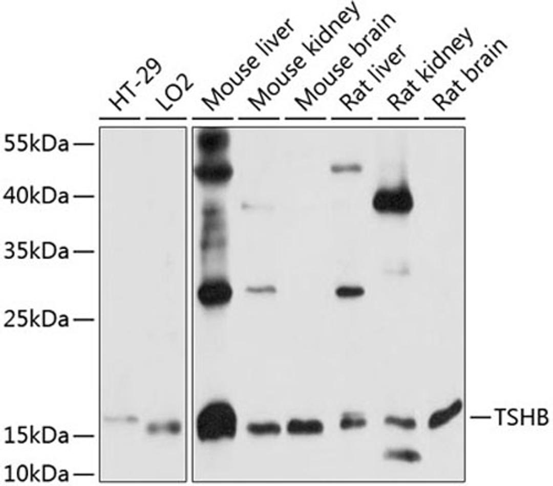 Western blot - TSHB antibody (A14523)