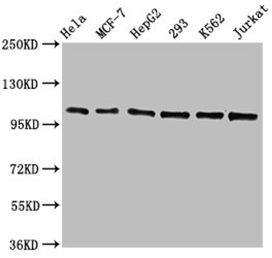 Western Blot. Positive WB detected in: Hela whole cell lysate, MCF-7 whole cell lysate, HepG2 whole cell lysate, 293 whole cell lysate, K562 whole cell lysate, Jurkat whole cell lysate. All lanes: CDC5L antibody at 1.3μg/ml. Secondary. Goat polyclonal to rabbit IgG at 1/50000 dilution. Predicted band size: 93 KDa. Observed band size: 100 KDa.