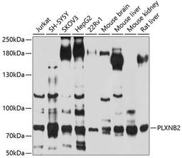 Western blot - PLXNB2 antibody (A10069)