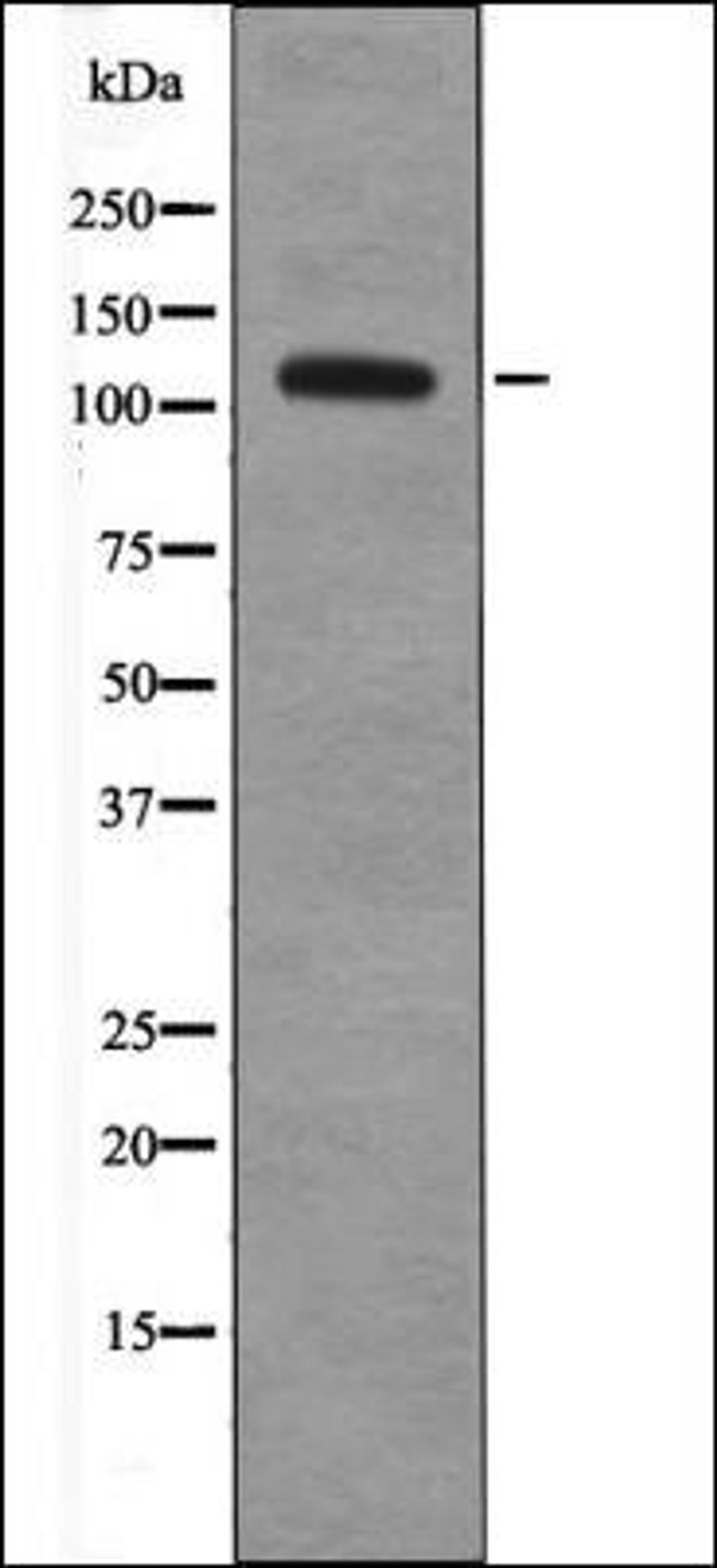 Western blot analysis of UV treated A549 whole cell lysates using EPHA8 -Phospho-Tyr615- antibody