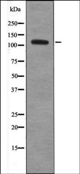 Western blot analysis of UV treated A549 whole cell lysates using EPHA8 -Phospho-Tyr615- antibody