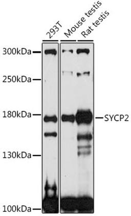 Western blot - SYCP2 antibody (A16098)