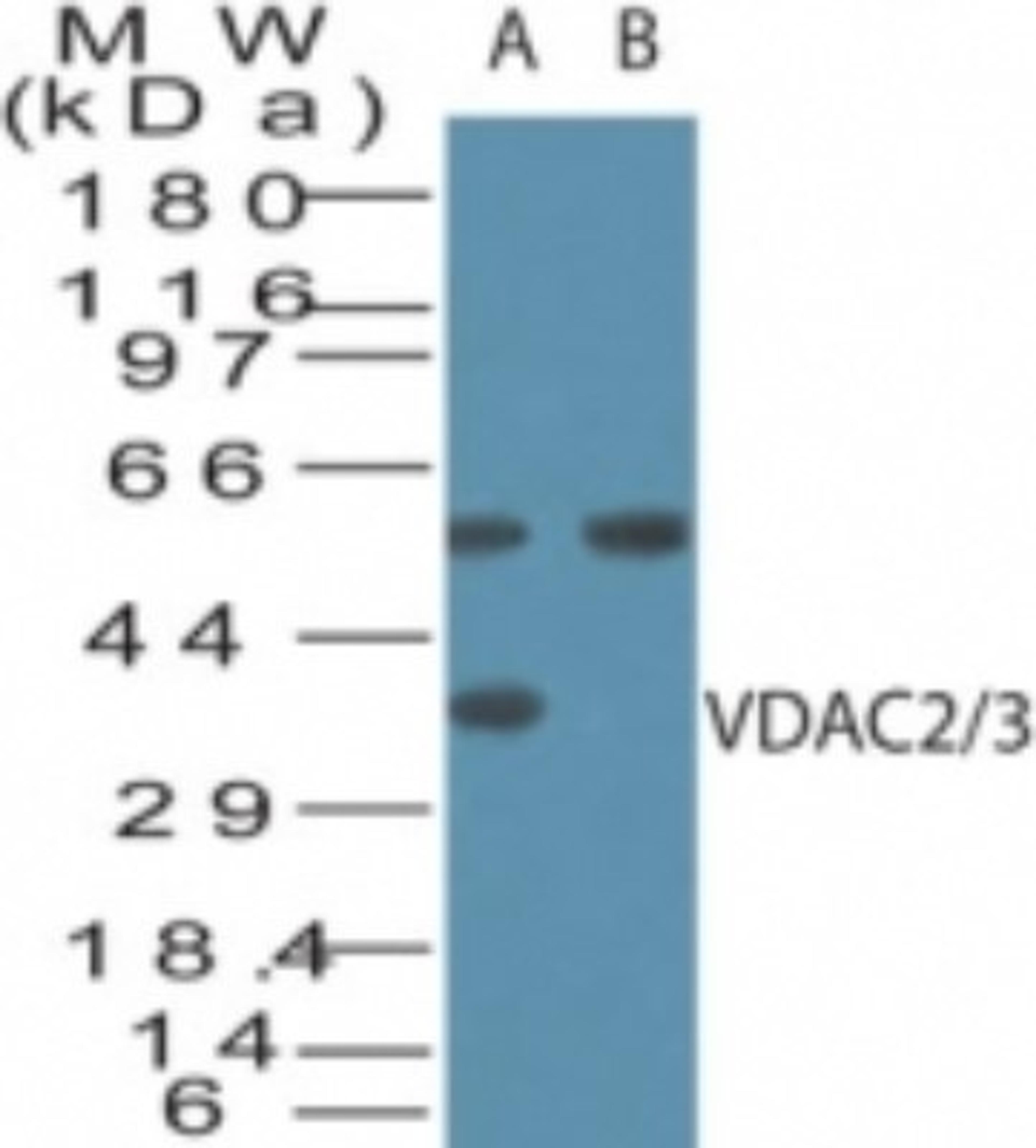 Western Blot: VDAC2/3 Antibody [NB100-56463] - analysis of VDAC2/3 in human brain cell lysate in the A) absence and B) presence of immunizing peptide using this antibody. The approximately 55 kD band is not blocked by the immunizing peptide and is believed to result from non-specific cross-reaction.