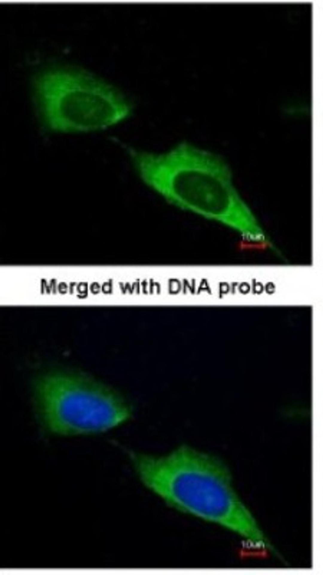 Immunocytochemistry/Immunofluorescence: MTMR9 Antibody [NBP1-31078] - Paraformaldehyde-fixed HeLa, using antibody at 1:200 dilution.