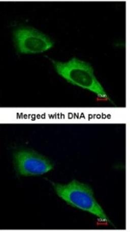 Immunocytochemistry/Immunofluorescence: MTMR9 Antibody [NBP1-31078] - Paraformaldehyde-fixed HeLa, using antibody at 1:200 dilution.