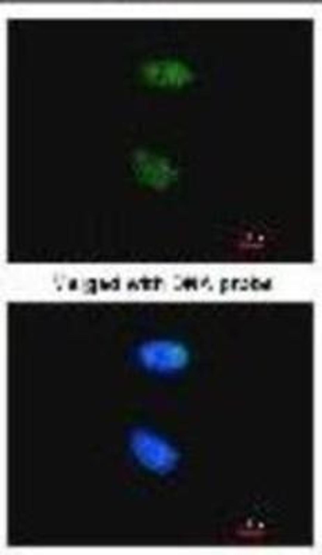 Immunocytochemistry/Immunofluorescence: XPC Antibody (3.26) [NB100-477] - Analysis of HeLa, using  1:100 dilution.