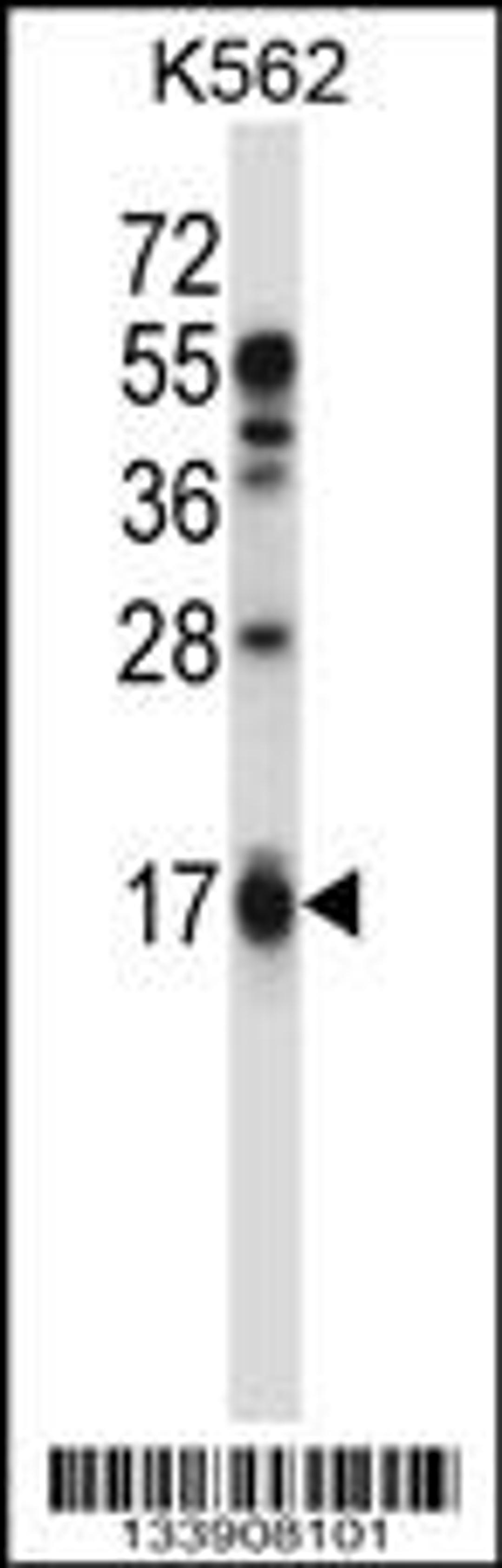 Western blot analysis in K562 cell line lysates (35ug/lane).