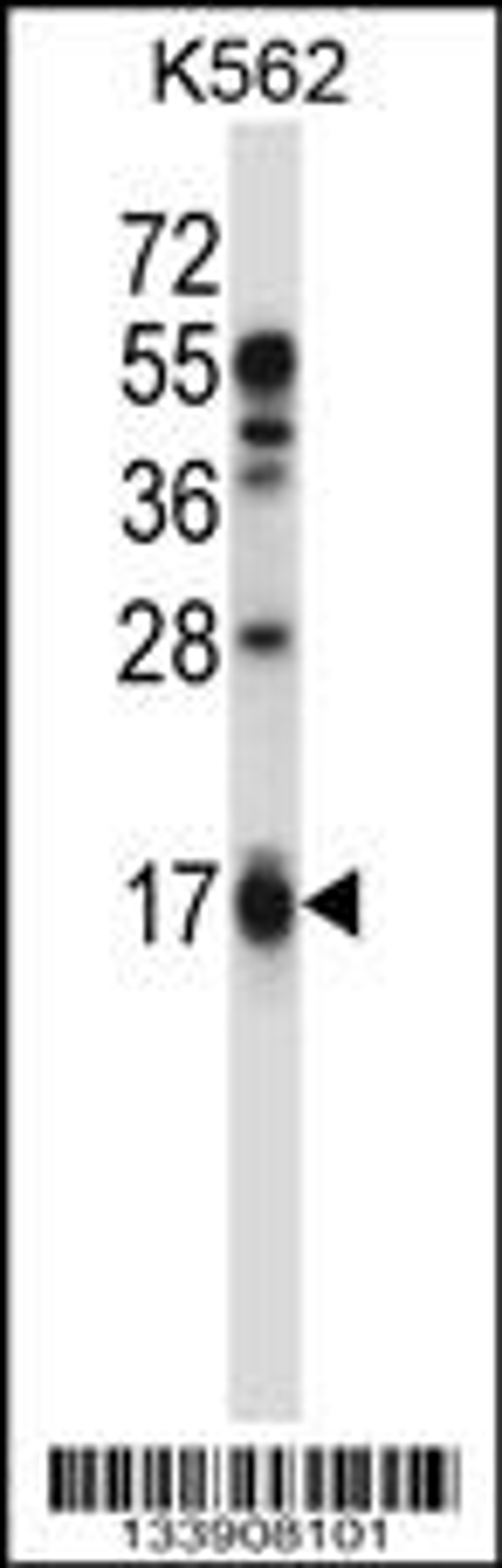 Western blot analysis in K562 cell line lysates (35ug/lane).