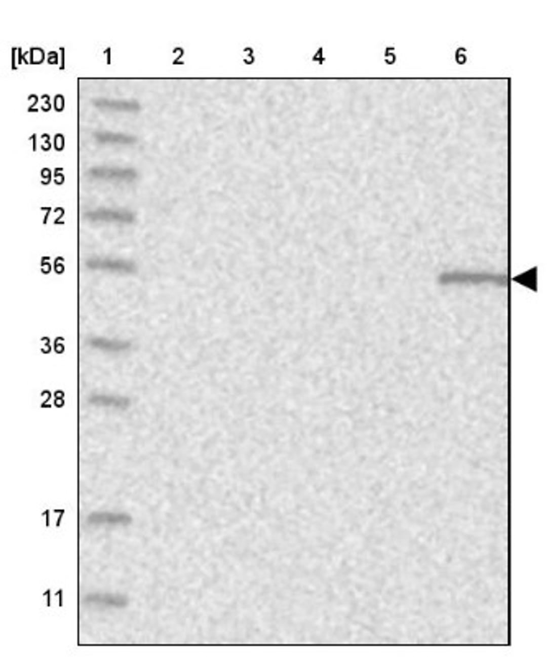 Western Blot: GCM2 Antibody [NBP1-83384] - Lane 1: Marker [kDa] 230, 130, 95, 72, 56, 36, 28, 17, 11<br/>Lane 2: Human cell line RT-4<br/>Lane 3: Human cell line U-251MG sp<br/>Lane 4: Human plasma (IgG/HSA depleted)<br/>Lane 5: Human liver tissue<br/>Lane 6: Human tonsil tissue