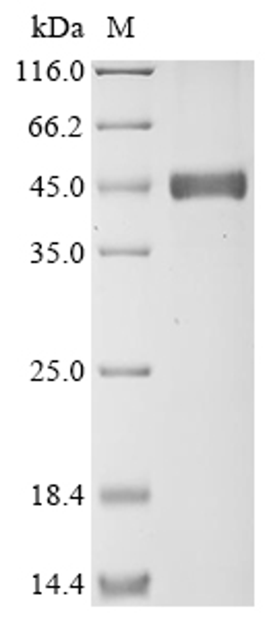 (Tris-Glycine gel) Discontinuous SDS-PAGE (reduced) with 5% enrichment gel and 15% separation gel.
