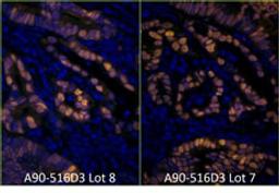 Detection of human p53 by immunofluorescence.