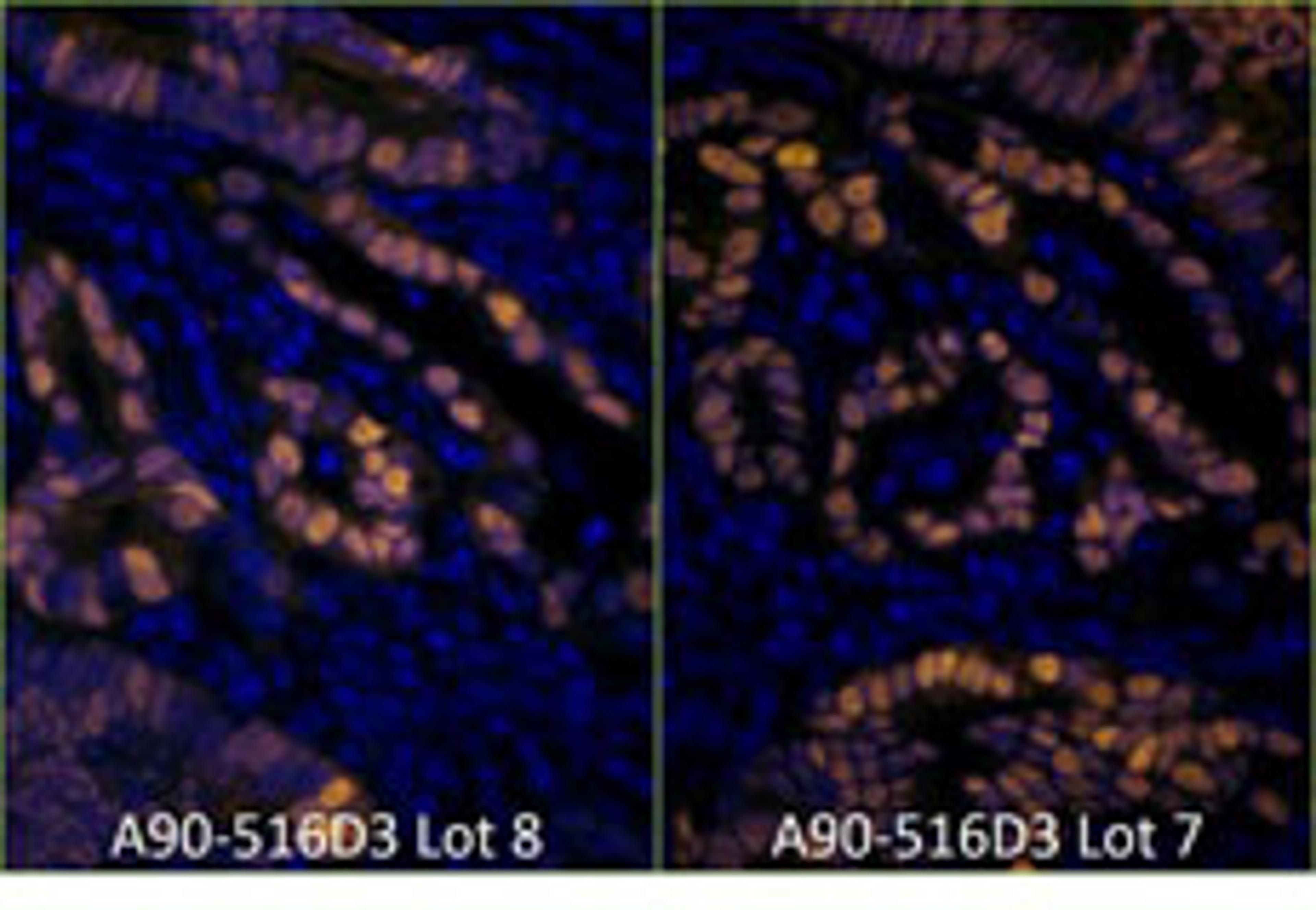 Detection of human p53 by immunofluorescence.