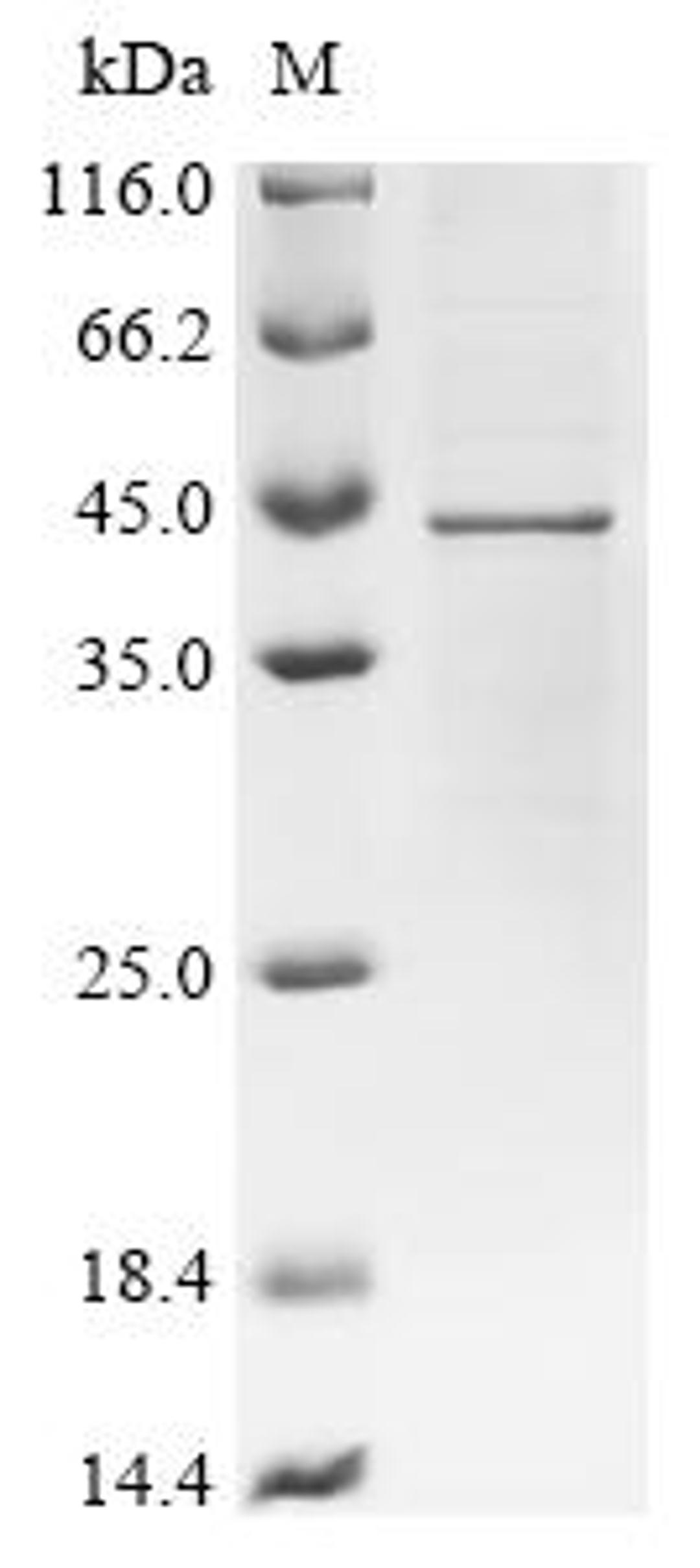 (Tris-Glycine gel) Discontinuous SDS-PAGE (reduced) with 5% enrichment gel and 15% separation gel.