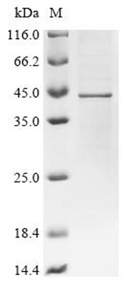 (Tris-Glycine gel) Discontinuous SDS-PAGE (reduced) with 5% enrichment gel and 15% separation gel.