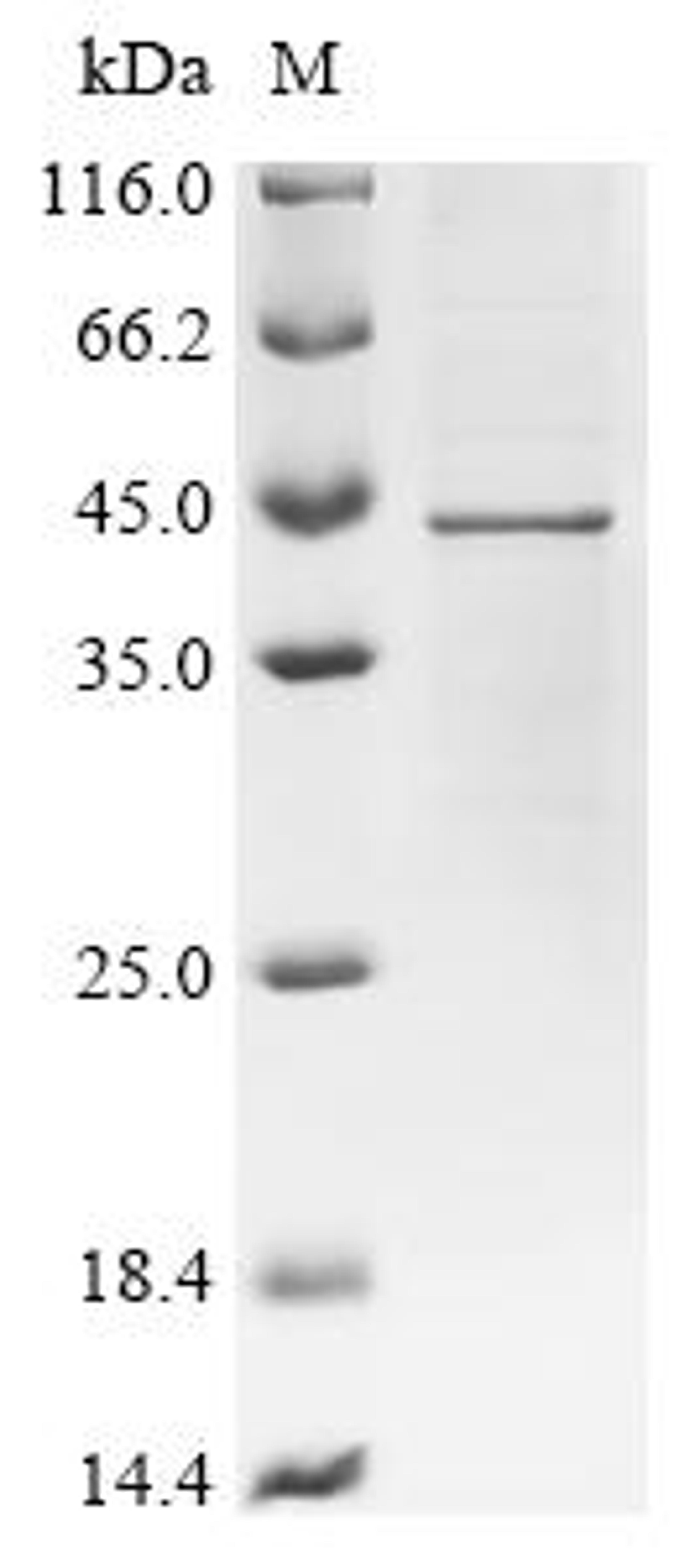 (Tris-Glycine gel) Discontinuous SDS-PAGE (reduced) with 5% enrichment gel and 15% separation gel.